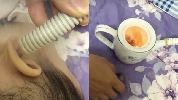 Sap Ong Tri Viem Tai Giua (8)